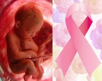 El aborto aumenta el riesgo de padecer cáncer de mama